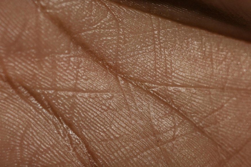 Close Up Photo of Human Palm Skin