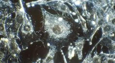 Hydrogen Atoms Used in Exploring Ancient History of Earth Can Also Help Track Cancer Growth