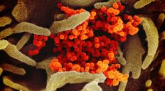 Microscope Image of Microbes