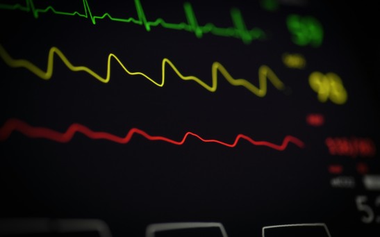 Monitor Displaying ECG Line