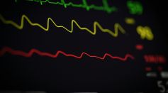 Monitor Displaying ECG Line
