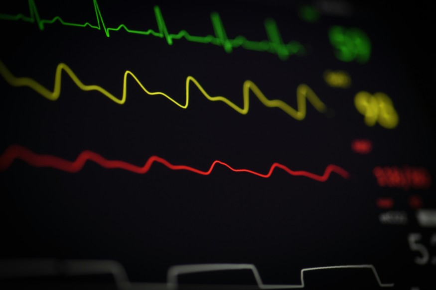 Monitor Displaying ECG Line