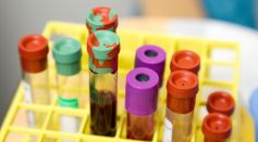 Vials of Blood