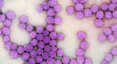 Virus Particles 