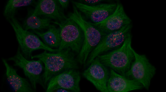 Nanotubes Target and Kill Triple-Negative Breast Cancer Cells, Offering New Insight in Targeted Drug Delivery